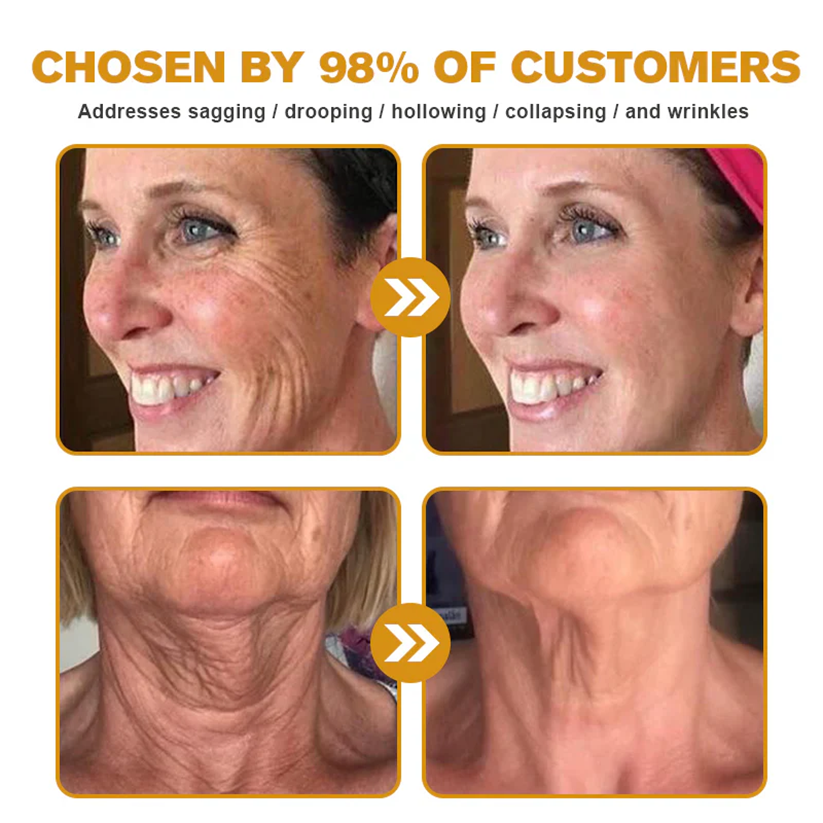 ✨FDA Approved: ODALIT® Bee Venom Skin Restoration Cream-🔥Limited Time 70%OFF 🔥
