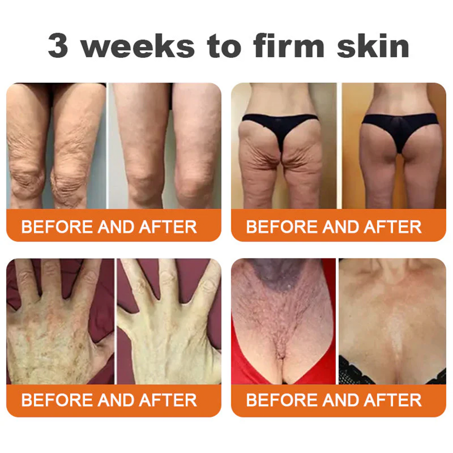 ✨FDA Approved: ODALIT® Bee Venom Skin Restoration Cream-🔥Limited Time 70%OFF 🔥