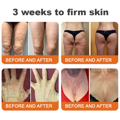 ✨FDA Approved: ODALIT® Bee Venom Skin Restoration Cream-🔥Limited Time 70%OFF 🔥
