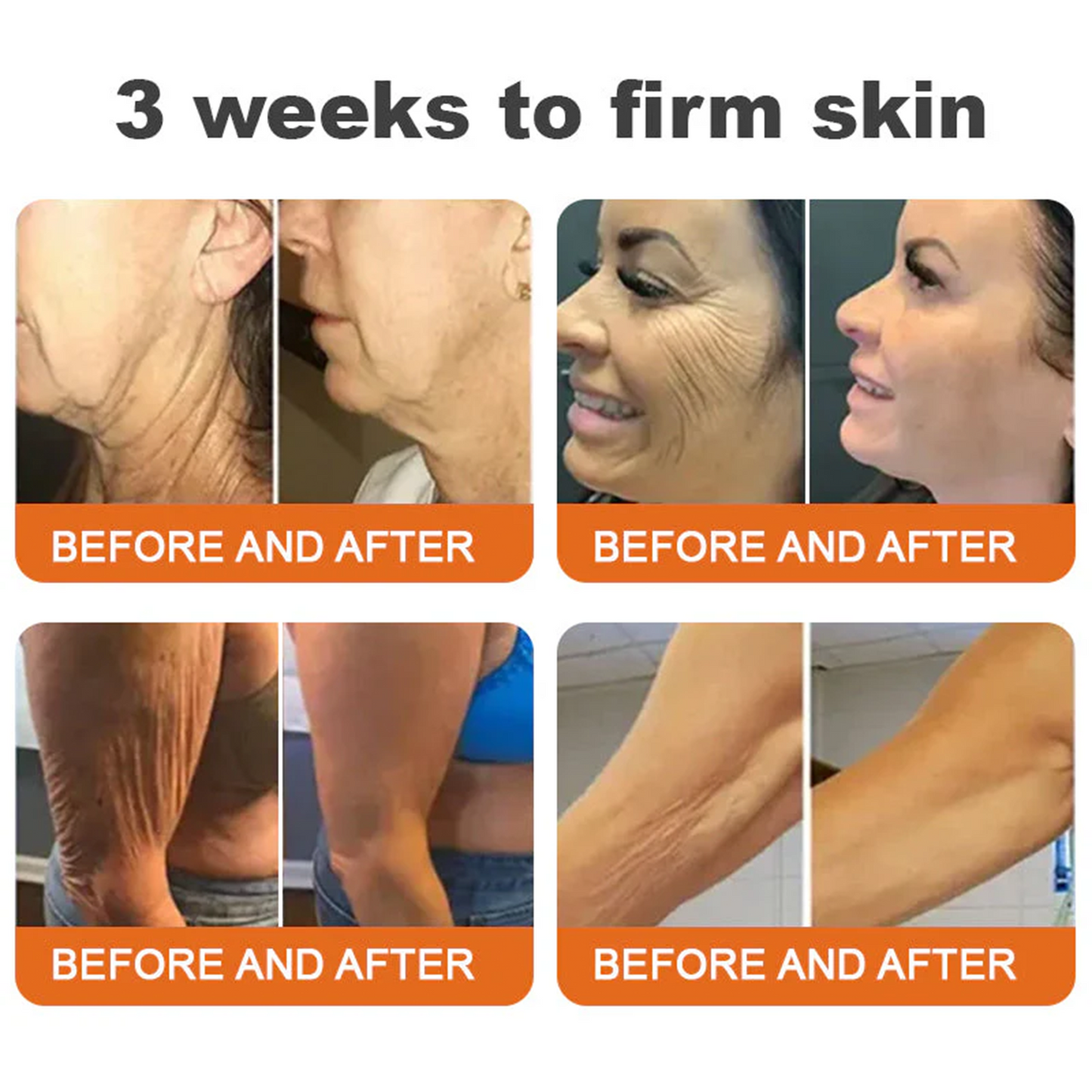✨FDA Approved: ODALIT® Bee Venom Skin Restoration Cream-🔥Limited Time 70%OFF 🔥