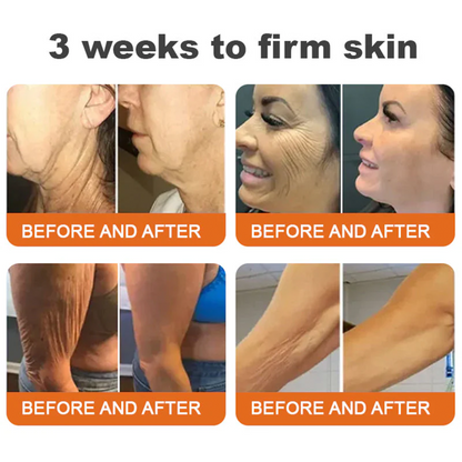 ✨FDA Approved: ODALIT® Bee Venom Skin Restoration Cream-🔥Limited Time 70%OFF 🔥