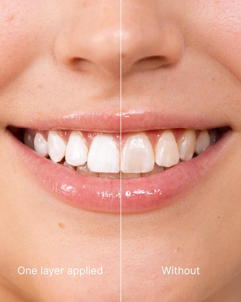ODALIT™ Teeth Polish - Instant White Teeth-Limited Time 75%OFF Buy 1 Get 2 Free 🔥LAST DAY⏰
