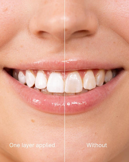 ODALIT™ Teeth Polish - Instant White Teeth-Limited Time 75%OFF Buy 1 Get 2 Free 🔥LAST DAY⏰