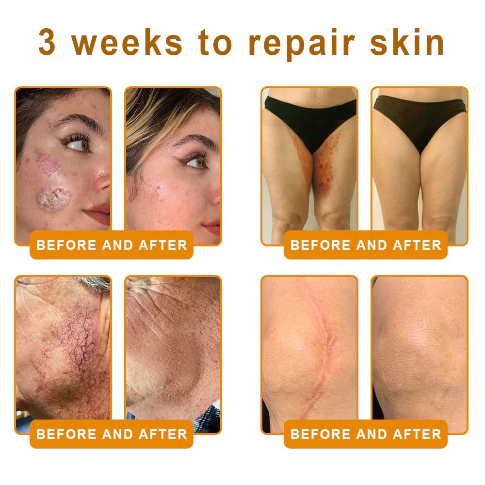 ✨FDA Approved: ODALIT® Bee Venom Skin Restoration Cream-🔥Limited Time 70%OFF 🔥